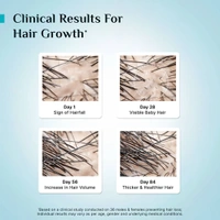 Pilgrim 3% Redensyl & 4% Anagain Advanced Hair Growth Serum 25ml Roll-On | Korean Black Rice Scalp Treatment | Controls Hair Fall, Boosts Regrowth & Density