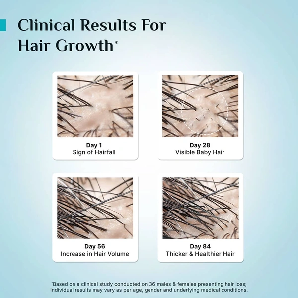 Pilgrim 3% Redensyl & 4% Anagain Advanced Hair Growth Serum 25ml Roll-On | Korean Black Rice Scalp Treatment | Controls Hair Fall, Boosts Regrowth & Density