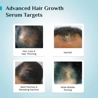 Pilgrim 3% Redensyl & 4% Anagain Advanced Hair Growth Serum 25ml Roll-On | Korean Black Rice Scalp Treatment | Controls Hair Fall, Boosts Regrowth & Density