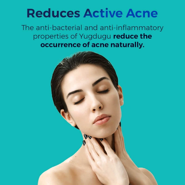 Pilgrim Anti-Acne Serum Salicylic & Glycolic Acid, 30ml | Clears Breakouts, Reduces Blackheads, and Exfoliates Skin for a Smooth, Clear Complexion.