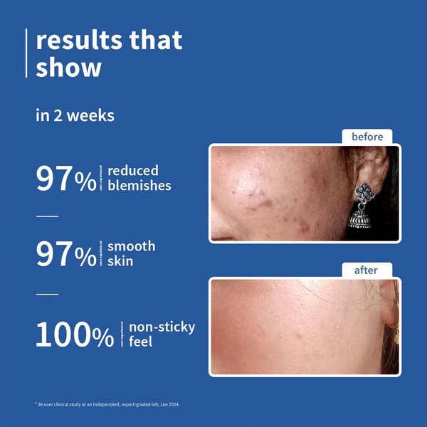 Plum 10% Niacinamide Serum with Rice Water 30ml | Brightening, Clear & Glowing Skin | Anti-Acne & Oil Control Serum for Acne-Prone, Oily, Combination & Sensitive Skin