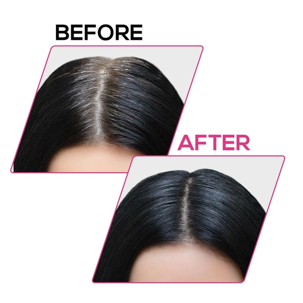 Renee RENEE Cover-Up Hair Powder ( Black ) 4g | Helps Cover Grey Roots & Patches | Highly Pigmented | Matte Finish | Invisible Flawless Finish | Instant Coverage | Long-Lasting