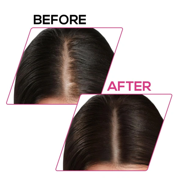 Renee RENEE Cover-Up Hair Powder ( Brown ) 4g | Helps Cover Grey Roots & Patches | Highly Pigmented | Matte Finish | Invisible Flawless Finish | Instant Coverage | Long-Lasting