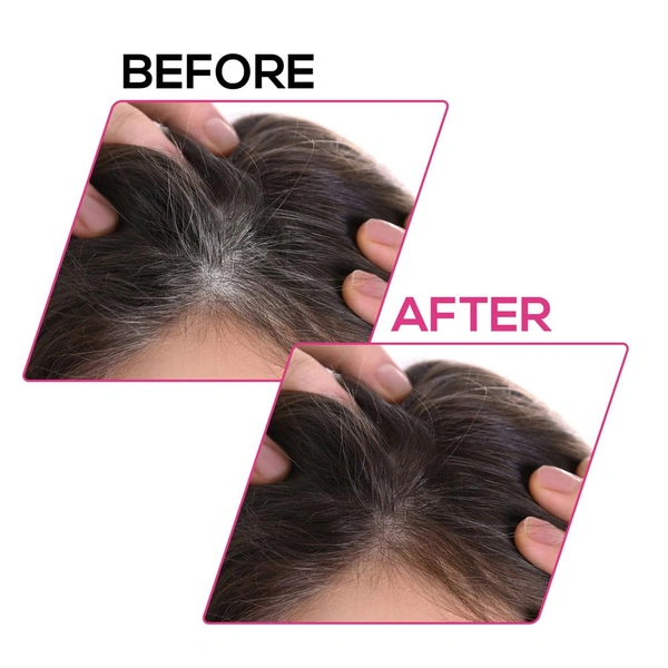 Renee RENEE Cover-Up Hair Powder ( Brown ) 4g | Helps Cover Grey Roots & Patches | Highly Pigmented | Matte Finish | Invisible Flawless Finish | Instant Coverage | Long-Lasting