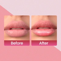 Swiss Beauty Cool-Pink Love & Care Lip Balm SPF 15 | Hydrating & Nourishing | Protects, Softens & Adds a Natural Tint | Enriched with Shea Butter & Vitamin E