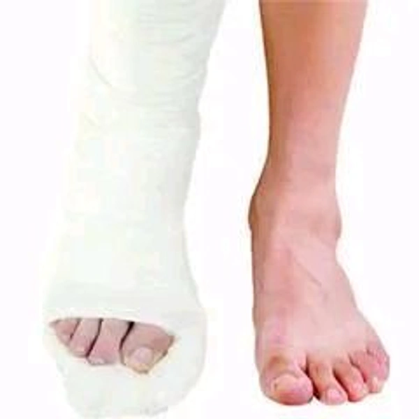 POP Plaster Of Paris 6"inchi (Pack Of 2)