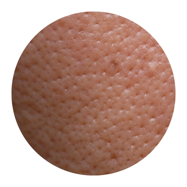 Open Pores