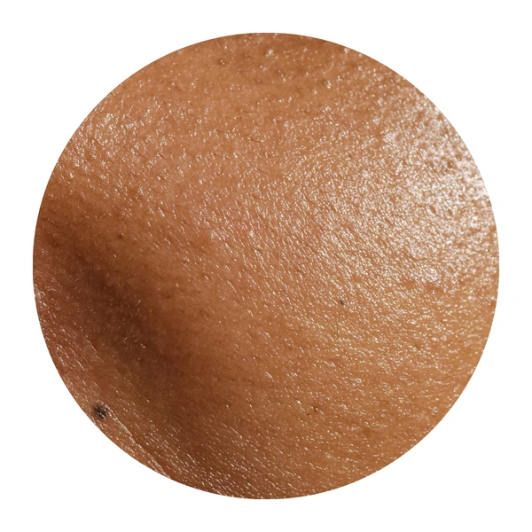 Dull Skin