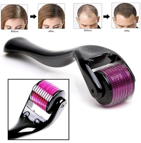 Trendy Styler 540 Titanium Needle Derma Roller for Face & Hair – Microneedle Skin Therapy Tool for Anti-Aging, Scar Reduction & Collagen Boosting