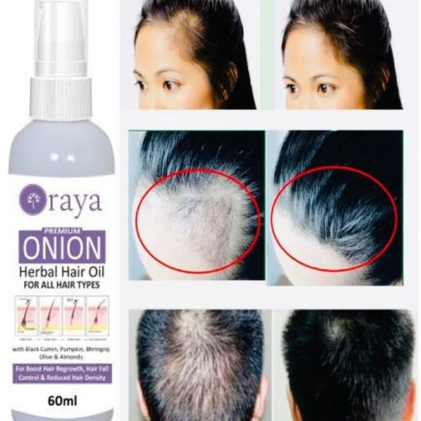   Onion Hair Oil For Hair Growth & Anti Dandruff Oil & Onion Shampoo For Men & Women