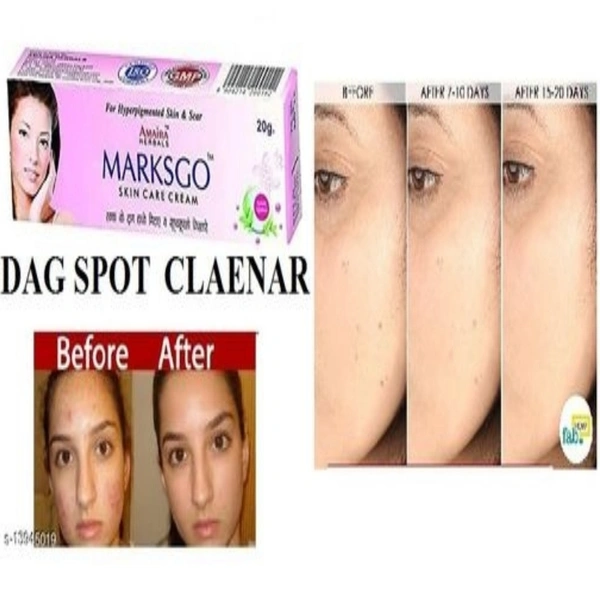 MARKSGO FAYERNES  CREAM (PECK OF 1) (Product Price+ Shpping Price) (80+80)