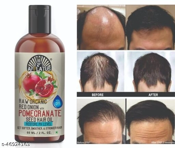 Afflatus Onion Hair Oil with 14 Essential Oils, Onion Hair Oil For Hair Growth