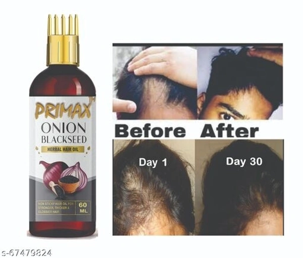 Primax Onion Fast Hair Growth Oil - With Comb Applicator