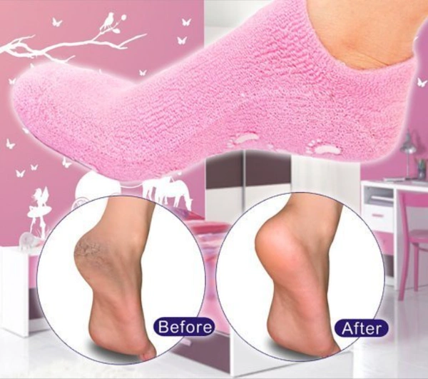 Spa Moisturizing Cracked Skincare Gel Therapy Gel Socks (1 Pair) - Pink, Cotton and spandex  Inner composition: 98% thermoplastic rubber  0.5% jojoba oil  0.5% olive oil  0.5% vitamin E  0.5% lavender oil