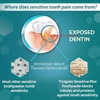 Colgate Sensitive Plus Toothpaste - Anticavity - 70g